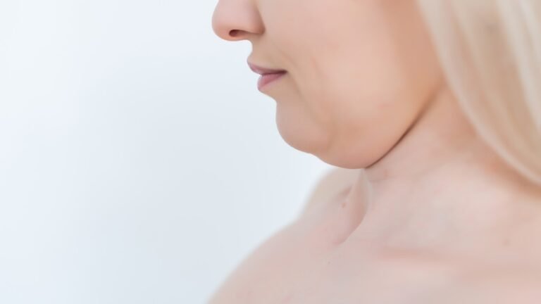 double chin surgery