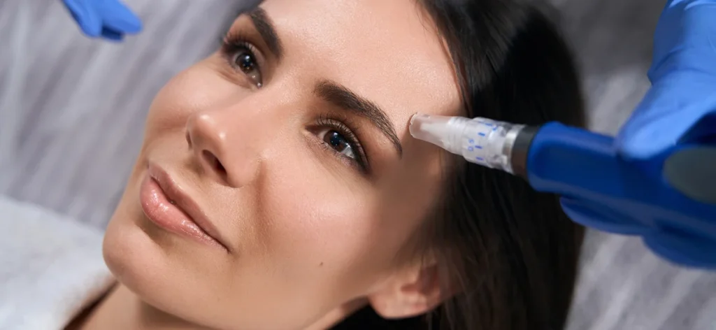 Transformative Power Of Microneedling For Skin
