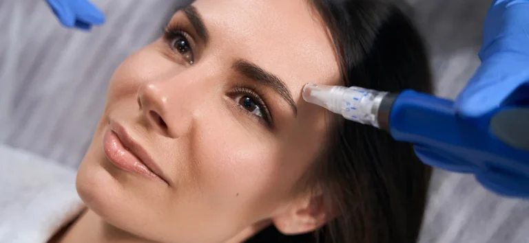 Transformative Power Of Microneedling For Skin