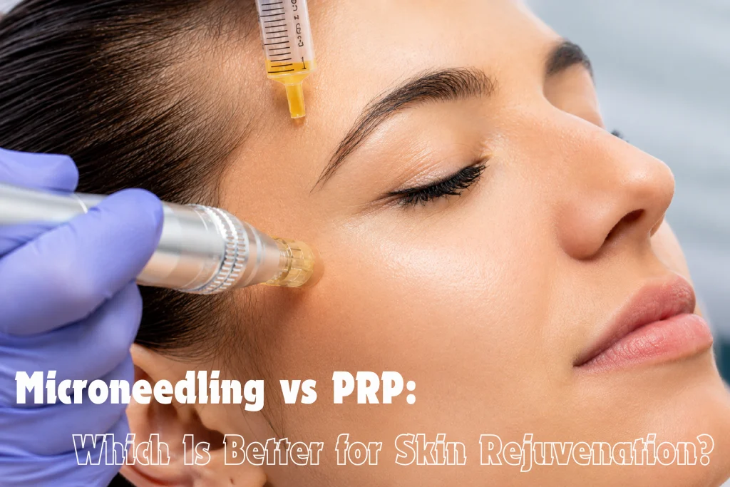 Microneedling Vs Prp Which Is Better For Skin Rejuvenation